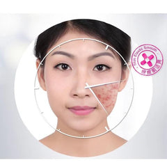 BIOAQUA Anti Acne Cream Acne Scar Removal Cream